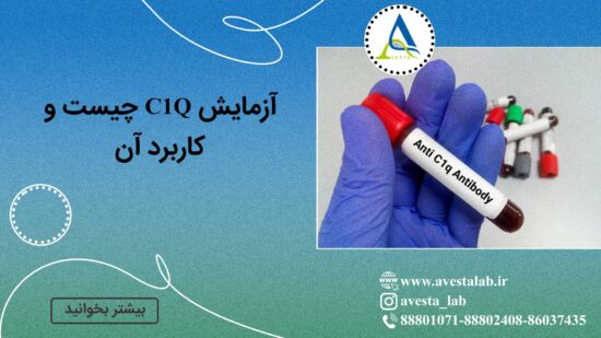آزمایش C1Q چیست و کاربرد آن