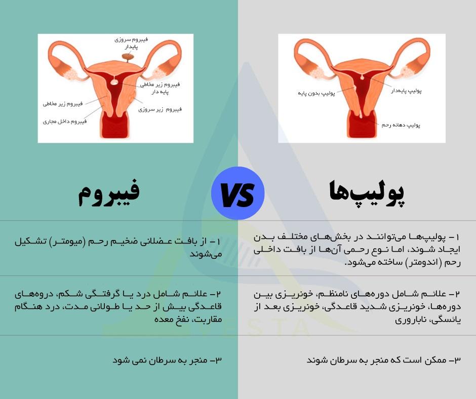 تفاوت پولیپ و فیبروم رحم