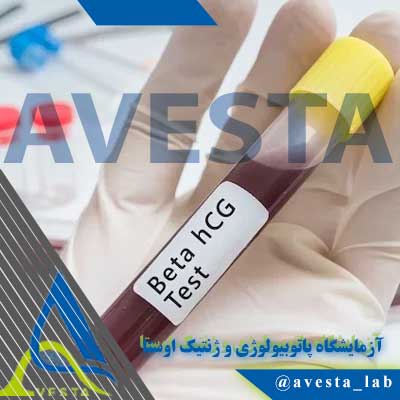 آزمایش هورمون hCG و تشخیص بارداری