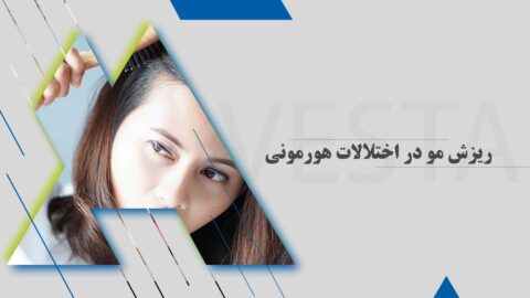 ریزش مو در اختلالات هورمونی