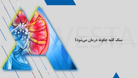 سنگ کلیه چگونه درمان می‌شود؟