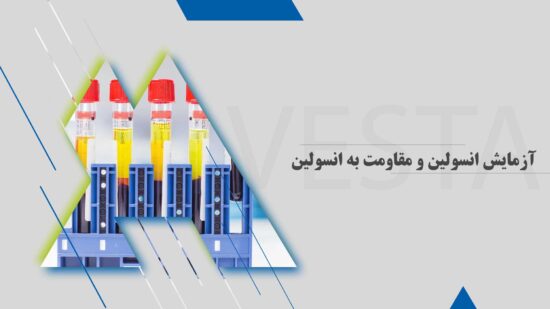 آزمایش انسولین و مقاومت به انسولین