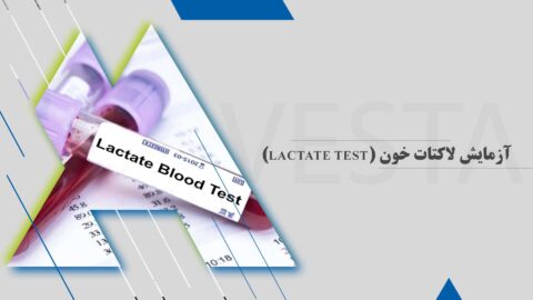 آزمایش لاکتات خون (Lactate test)