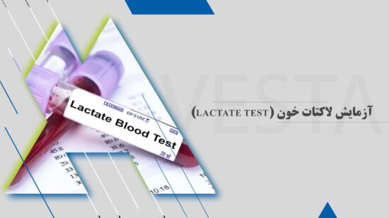 آزمایش لاکتات خون (Lactate test)
