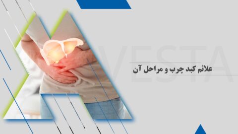 علائم کبد چرب و مراحل آن