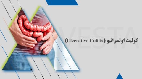 کولیت اولسراتیو (Ulcerative Colitis)