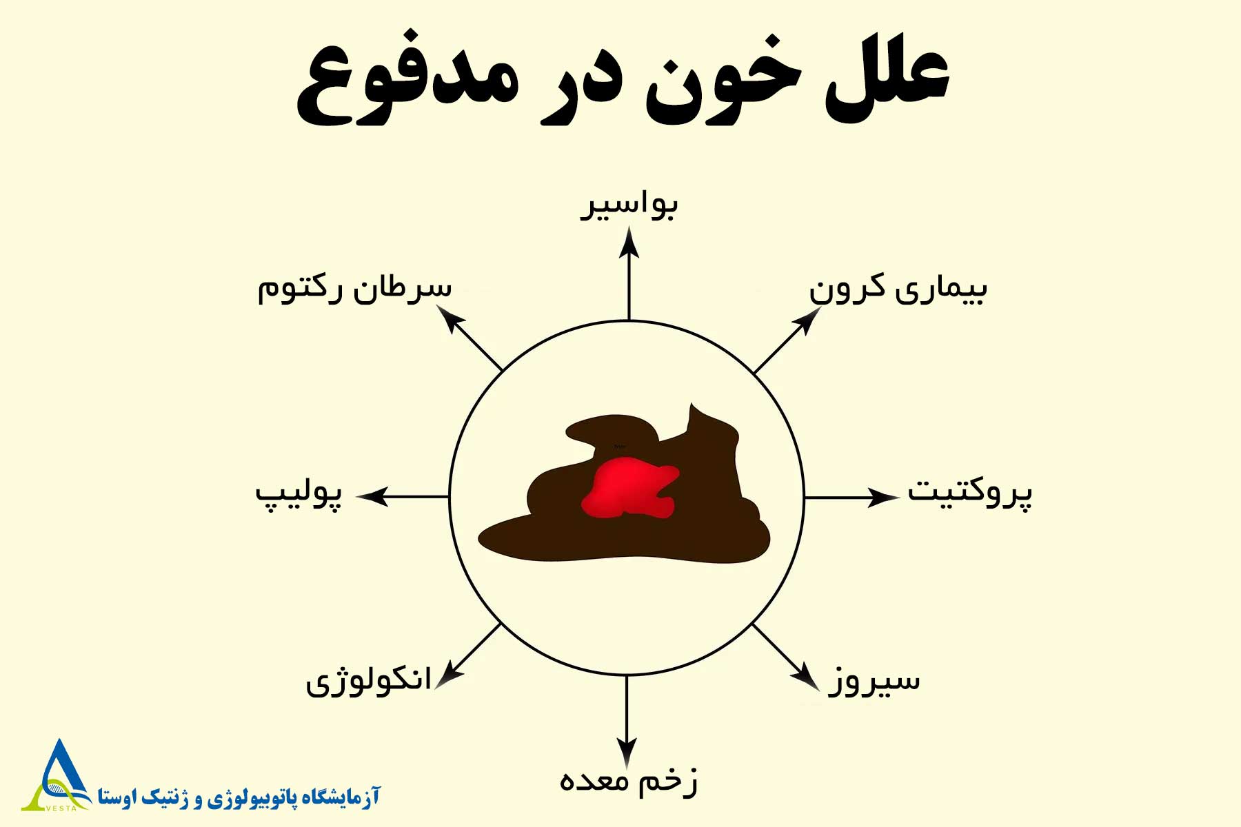 خون در مدفوع؛ علل و درمان