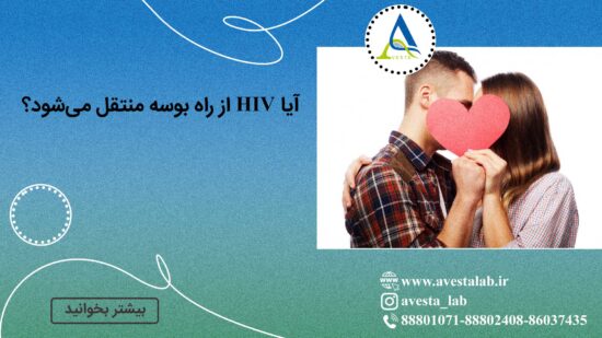 آیا HIV از راه بوسه منتقل می شود؟