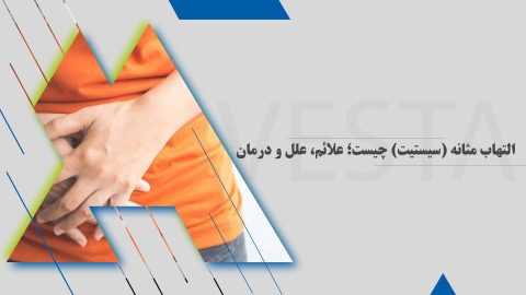 التهاب مثانه (سیستیت) چیست؟ علائم، علل، درمان و پیشگیری