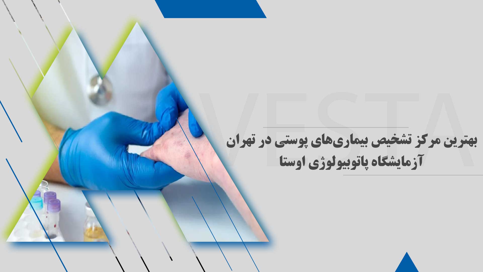 بهترین مرکز تشخیص بیماری‌های پوستی در تهران | آزمایشگاه پاتوبیولوژی اوستا
