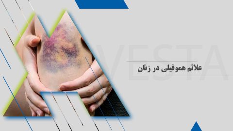 علائم هموفیلی در زنان | آزمایشگاه پاتوبیولوژی اوستا