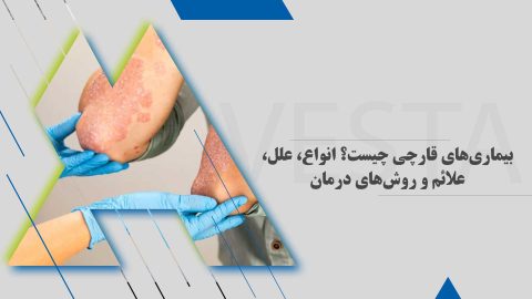 بیماری‌های قارچی چیست؟ انواع، علل، علائم و روش‌های درمان