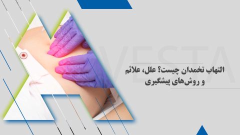 التهاب تخمدان چیست؟ علل، علائم و روش‌های پیشگیری