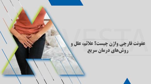 عفونت قارچی واژن چیست؟ علائم، علل و روش‌های درمان سریع
