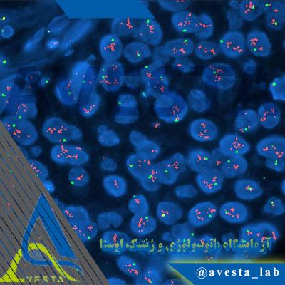 آزمایش FISH برای تشخیص ناهنجاریها | کاربرد، روش انجام، تفسیر نتایج، مقادیر نرمال و نکات مهم