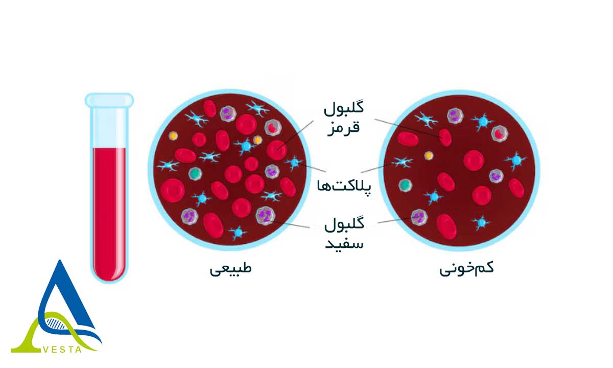 MCH در آزمایش خون