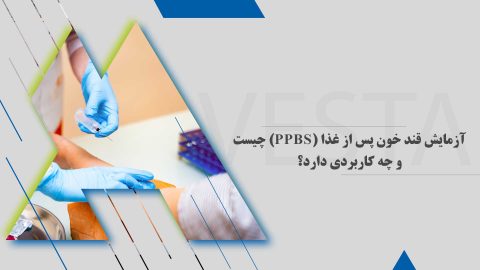 آزمایش قند خون پس از غذا (PPBS) چیست و چه کاربردی دارد؟