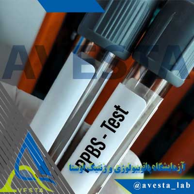 آزمایش قند خون پس از غذا (PPBS) چیست و چه کاربردی دارد؟