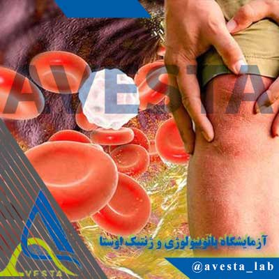 علائم چربی خون بالا چیست؟ راهنمای کامل نشانه‌های پنهان، پوستی و خطرناک