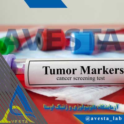 تومورمارکرها (Tumor Markers) چیست؟ آزمایشگاه پاتوبیولوژی و ژنتیک اوستا
