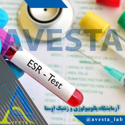 تفاوت آزمایش CRP و ESR؛ راهنمای کامل تشخیص التهاب بدن