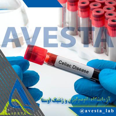 آزمایش tTG Antibodies جهت تشخیص سلیاک