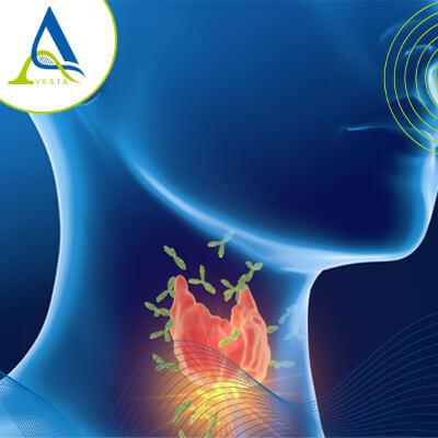 بیماری های مرتبط با اتو آنتی بادی های پلاسما