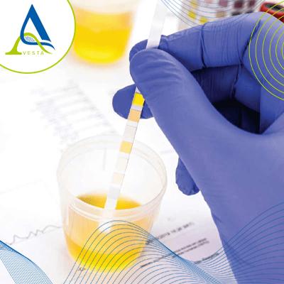 گلیکوزوری کلیوی (Renal glycosuria) چیست؟ علت، علائم، راه‌های تشخیص و درمان