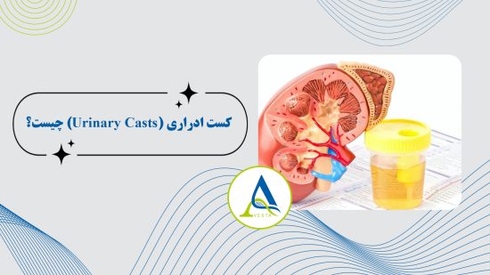 کست ادراری (Urinary Casts) چیست؟