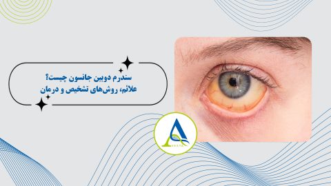 سندرم دوبین جانسون چیست؟ علائم، روش‌های تشخیص و درمان
