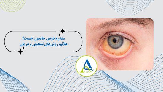 سندرم دوبین جانسون چیست؟ علائم، روش‌های تشخیص و درمان