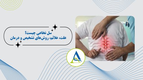 سل نخاعی چیست؟ علت، علائم، روش‌های تشخیص و درمان
