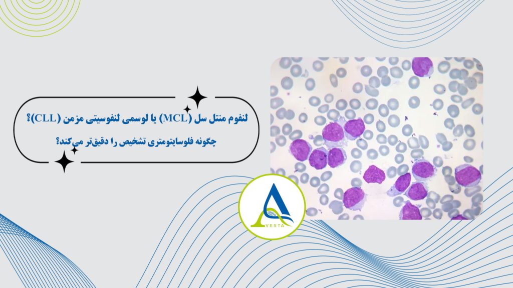 لنفوم منتل سل (MCL) یا لوسمی لنفوسیتی مزمن (CLL)؟ چگونه فلوسایتومتری تشخیص را دقیق‌تر می‌کند؟