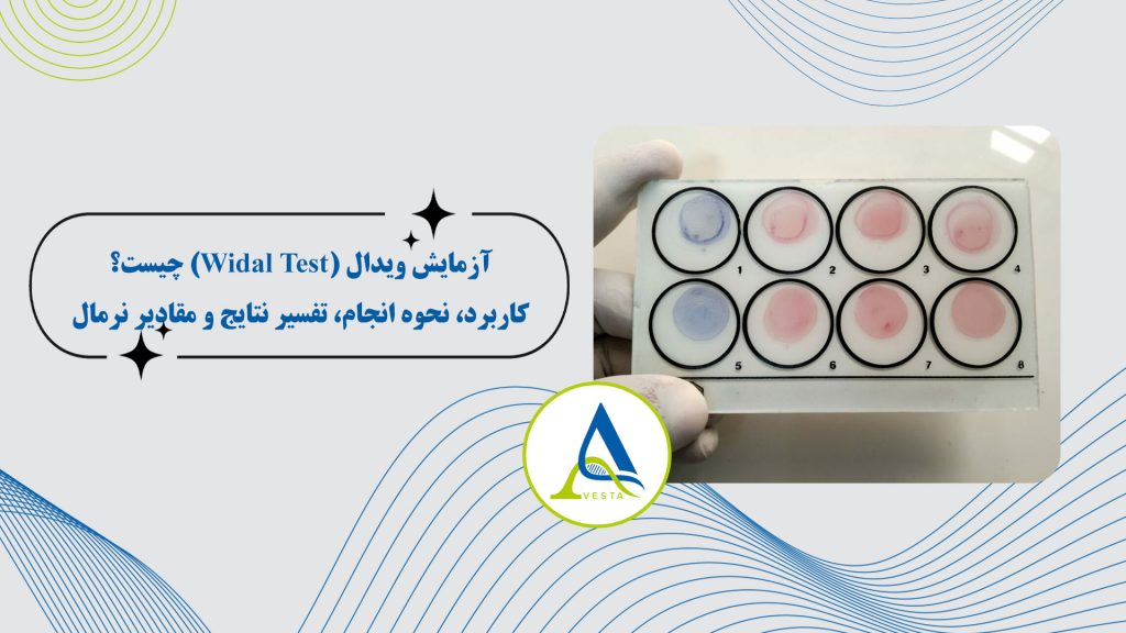 آزمایش ویدال (Widal Test) چیست؟ کاربرد، نحوه انجام، تفسیر نتایج و مقادیر نرمال