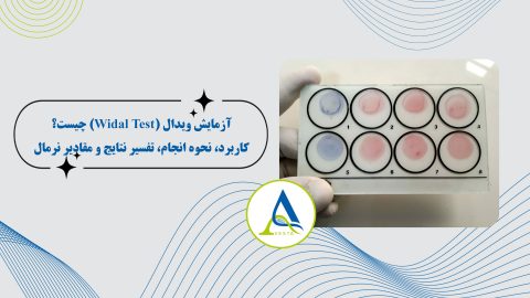 آزمایش ویدال (Widal Test) چیست؟ کاربرد، نحوه انجام، تفسیر نتایج و مقادیر نرمال