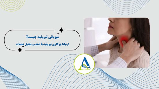 میوپاتی تیروئید چیست؟ | ارتباط پرکاری تیروئید با ضعف و تحلیل عضلات
