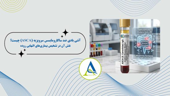 آنتی بادی ضد ساکارومایسس سرویزیه (ASCA) چیست؟ | نقش آن در تشخیص بیماری‌های التهابی روده