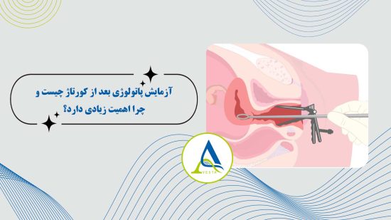 آزمایش پاتولوژی بعد از کورتاژ چیست و چرا اهمیت زیادی دارد؟