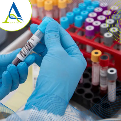 تفاوت جواب آزمایش در دو آزمایشگاه؛ چرا نتایج آزمایش در آزمایشگاه های مختلف متفاوت است؟