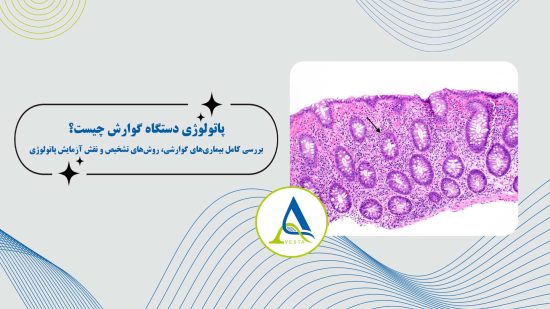 پاتولوژی دستگاه گوارش چیست؟ بررسی کامل بیماری‌های گوارشی، روش‌های تشخیص و نقش آزمایش پاتولوژی