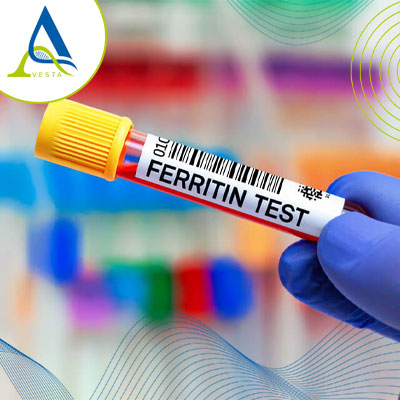 آزمایش Ferritin چیست؟ تفسیر فریتین و محدوده نرمال
