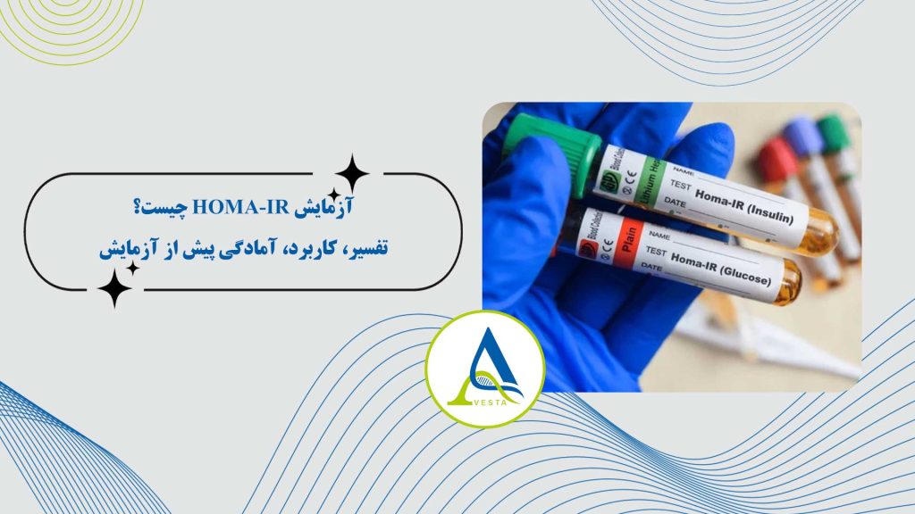 آزمایش HOMA-IR چیست؟ تفسیر، کاربرد، آمادگی پیش از آزمایش