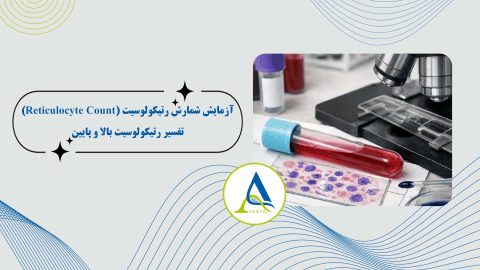 آزمایش شمارش رتیکولوسیت (Reticulocyte Count) چیست؟ تفسیر رتیکولوسیت بالا و پایین